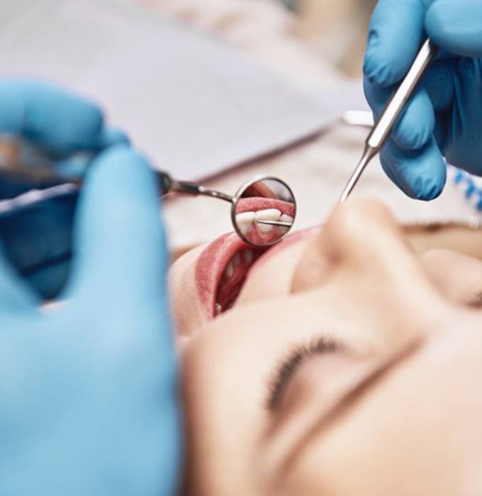 Close up of gloved hands checking a patient’s mouth with dental mirror